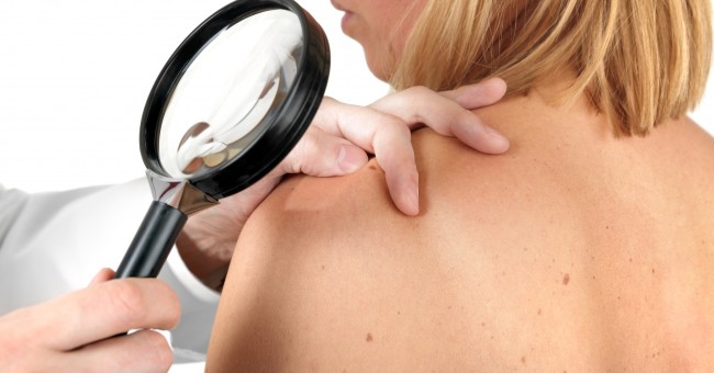 Melanoma Detection” App Sellers Barred from Making Deceptive Health Claims